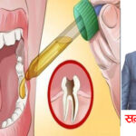 दाँत दुखाईको कारण अनि उपचारको विधि