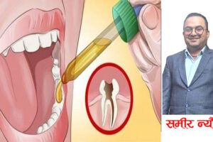 दाँत दुखाईको कारण अनि उपचारको विधि